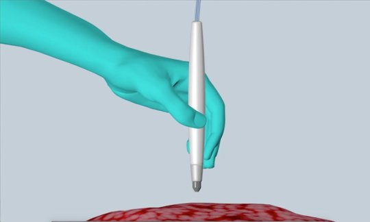 pen to detect cancer